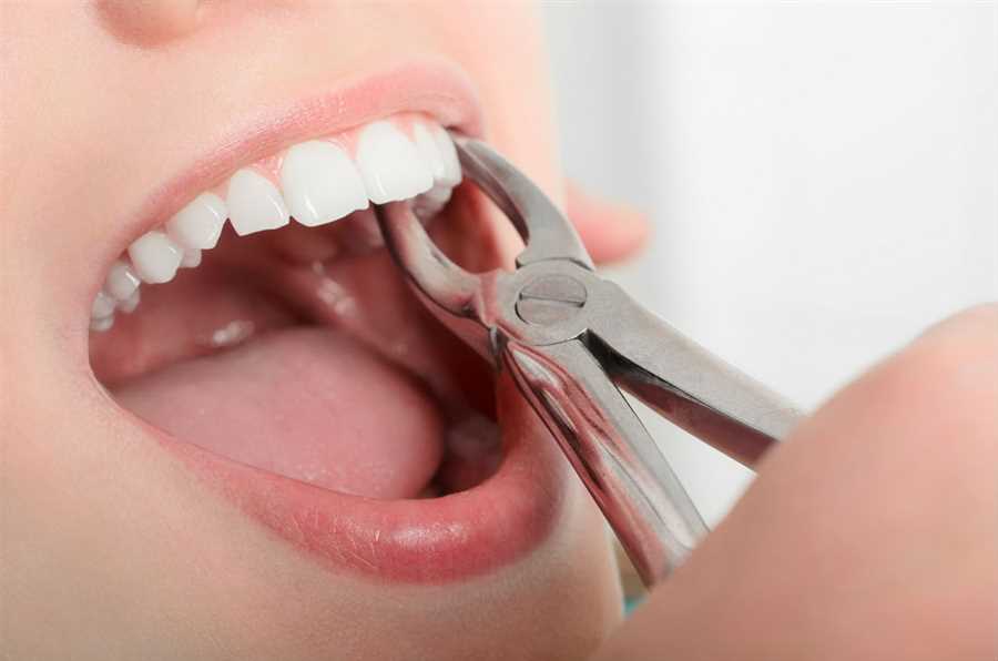 Painless Tooth Extractions in Mahatma Nagar Nashik